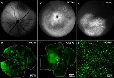 Present Molecular Limitations of ON-Bipolar Cell Targeted Gene Therapy